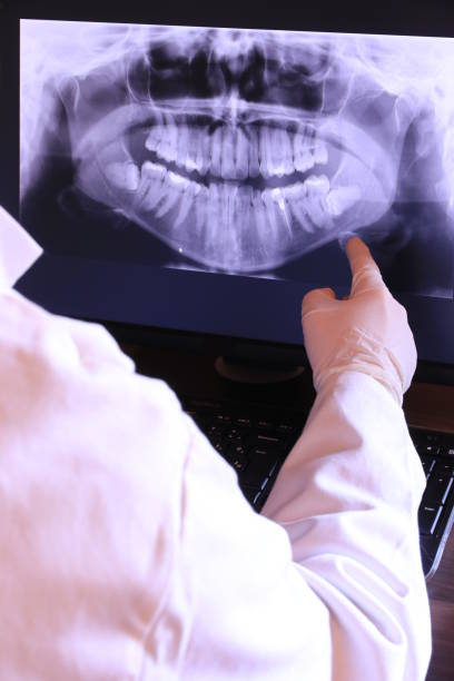 Best Broken or Cracked Tooth Emergency Dentist in Harbor Isle, NY
