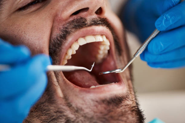 Best Pediatric Emergency Dentist in Harbor Isle, NY