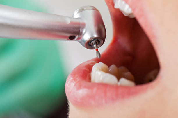 Best Urgent Dental Care for Toothache in Harbor Isle, NY
